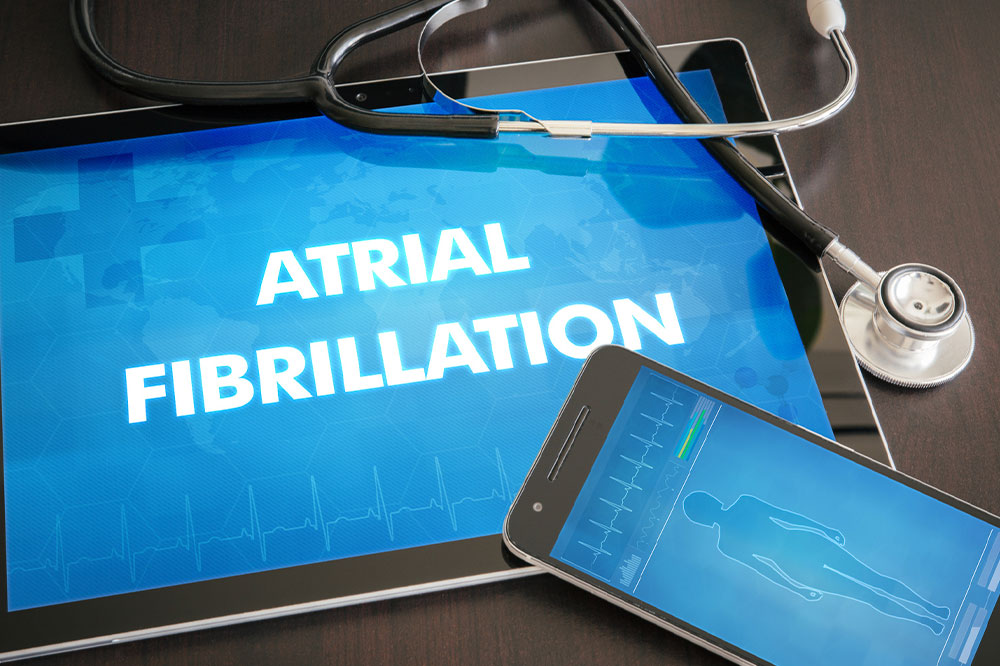 Afib – Types, causes, symptoms, and management