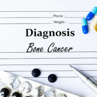 Bone cancer – Types, warning signs, lifestyle tips, and more