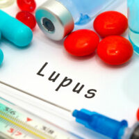 Lupus – Types and Warning Signs